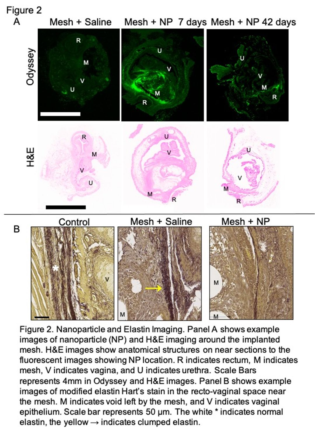 ICS 2021 Abstract #418 Nanoparticles Remain In The Pelvic Region And ...